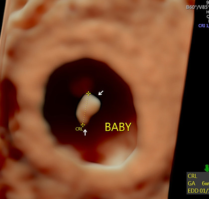 6 semanas 6 días de cr.jpg