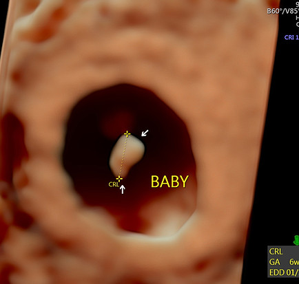 6 semanas 6 días de cr.jpg