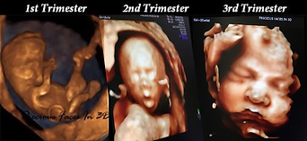 Ecografía del 1er trimestre, 2do trimestre, 3er trimestre