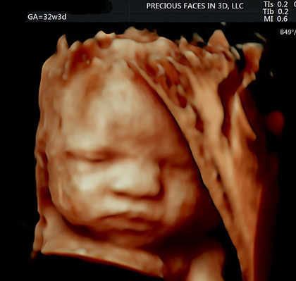 BABY GIRL 126.jpg