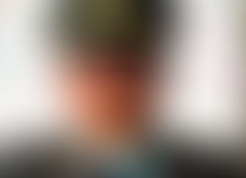 Subintendente de la Policía resultó herido a bala durante operativo en Sabanagrande