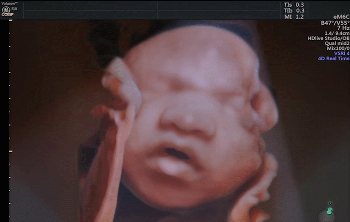 HEALTHSCAN Dx - 4D Ultrasound