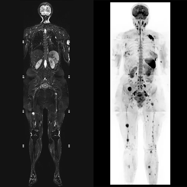 HEALTHSCAN Dx - Whole Body MRI