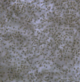 algaltoxinLCpg2.jpg