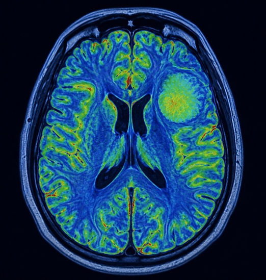 A close-up of a brain scan.jpg