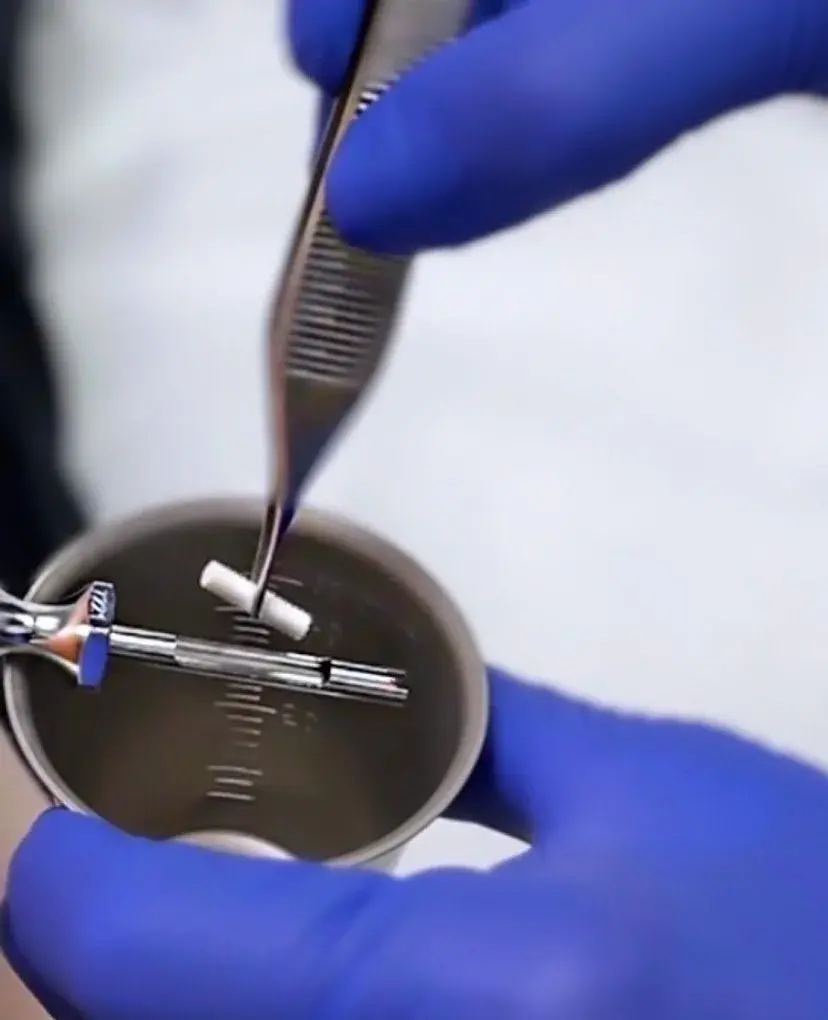 Medical professional handling a testosterone pellet.