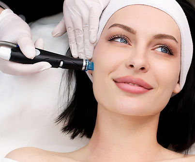 Hydrafacial-for-Acne_edited.jpg