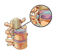 c spine images .001.jpeg