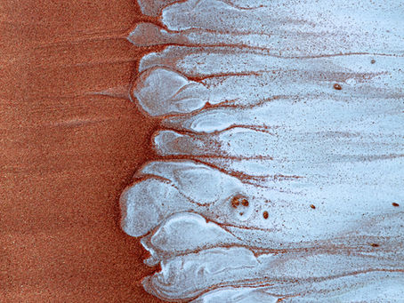 Ligamentous Articular Strain (LAS) Explained: Benefits, Techniques, and When It Helps