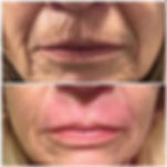 lips.jpeg