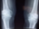 knee-2253047_1920.jpg