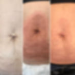 Accor Plasma Treatment