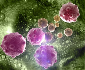 Body 29 Cancer Cells.jpg