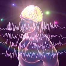 Akustik Sinir, Serebellopontin Köşe ve Alt Pons Lezyonlarında ABR Değerlendirmesi