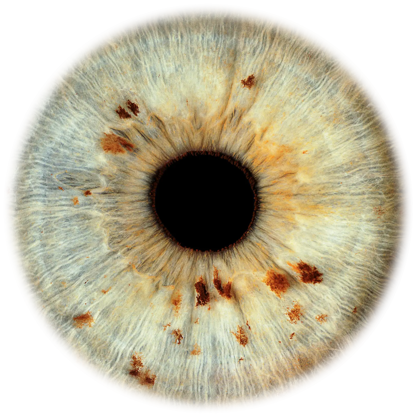 Echte Irisfotografie zu 100% echt und scharf von innen bis aussen