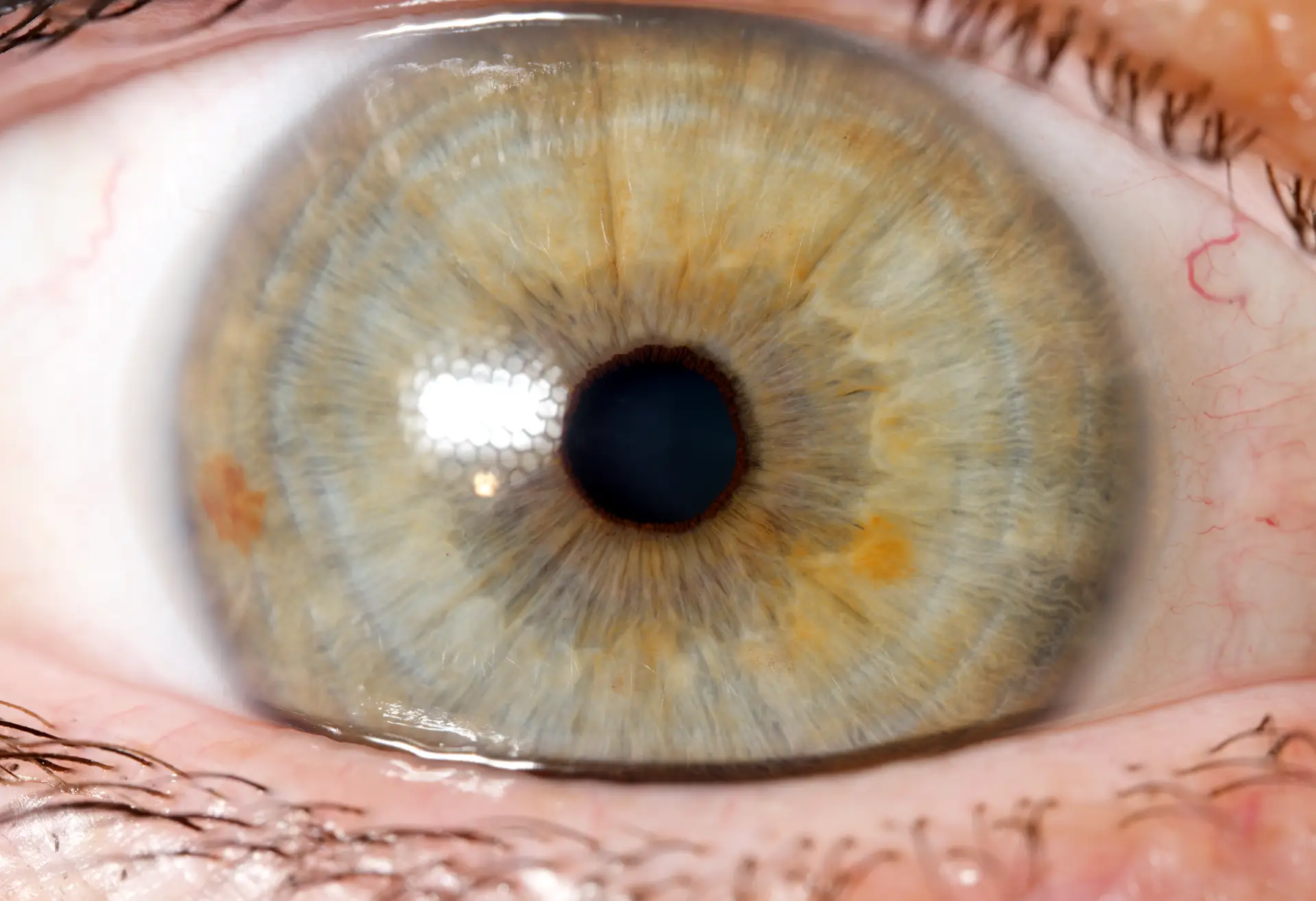 Reflexion in der Irisfotografie sollte nicht mit Phoshop Retusche weggemacht werden.