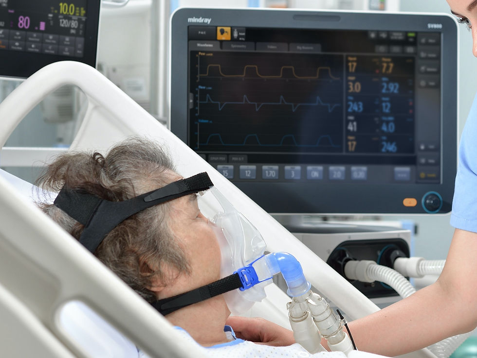 O embaraço dos Respiradores de Santa Catarina