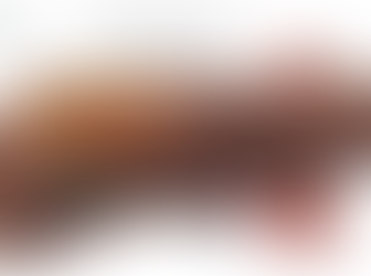 Microwave Ablation (MWA) for Solid Tumors