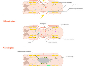 Can Stem Cells Help Regrow Nerves After an Injury