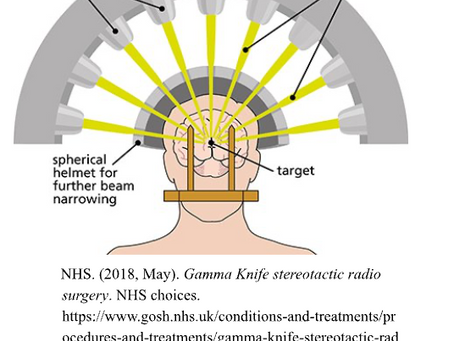 Surgery without a Knife: Gamma Knife Radiosurgery