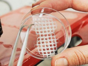 Bioprinting Skin Directly Onto Burn Wounds