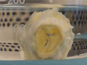 Use of Decellularized Scaffolds in Cardiac Tissue Repair