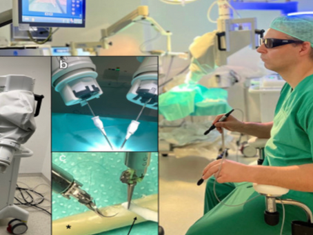 Robotic Lymphatic Supermicrosurgery (Symani System)