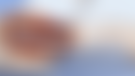 Rotationplasty: A Functional Approach to Limb Reconstruction and Mobility