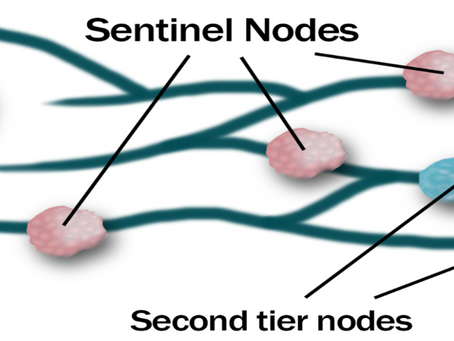 Sentinel Lymph Node Biopsy in Cancer Surgery
