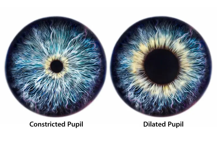 WebMD. Why Get Your Eyes Dilated?