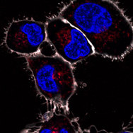 Engineering Programmable Artificial Organelles