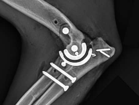 Andy Moores certified to perform 3rd generation TATE elbow replacements