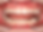 INNOSMILE | Perfect Clear Aligner
