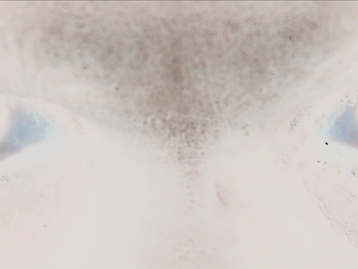 //html:://error//I CAN SEE YOU