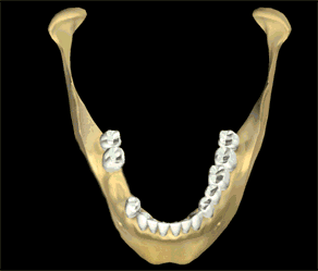 3Dbone-center.gif