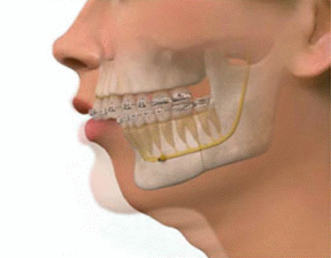 cirugia-maxilofacial-hospital-quiron-doctor-ruiz-villandiego-dentista-donostia-san-sebasti