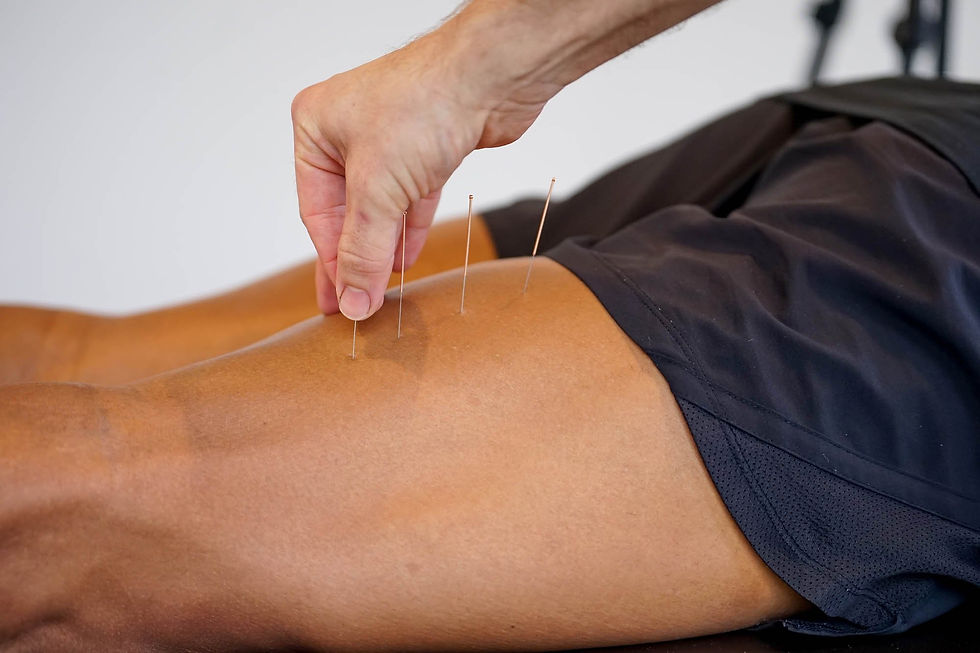 Physio dry needling patient's hamstrings