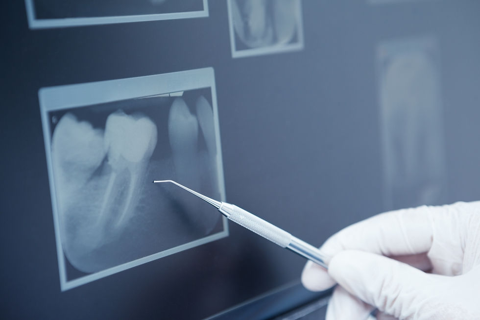 dental-x-ray.jpeg