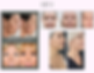 HIFU.png