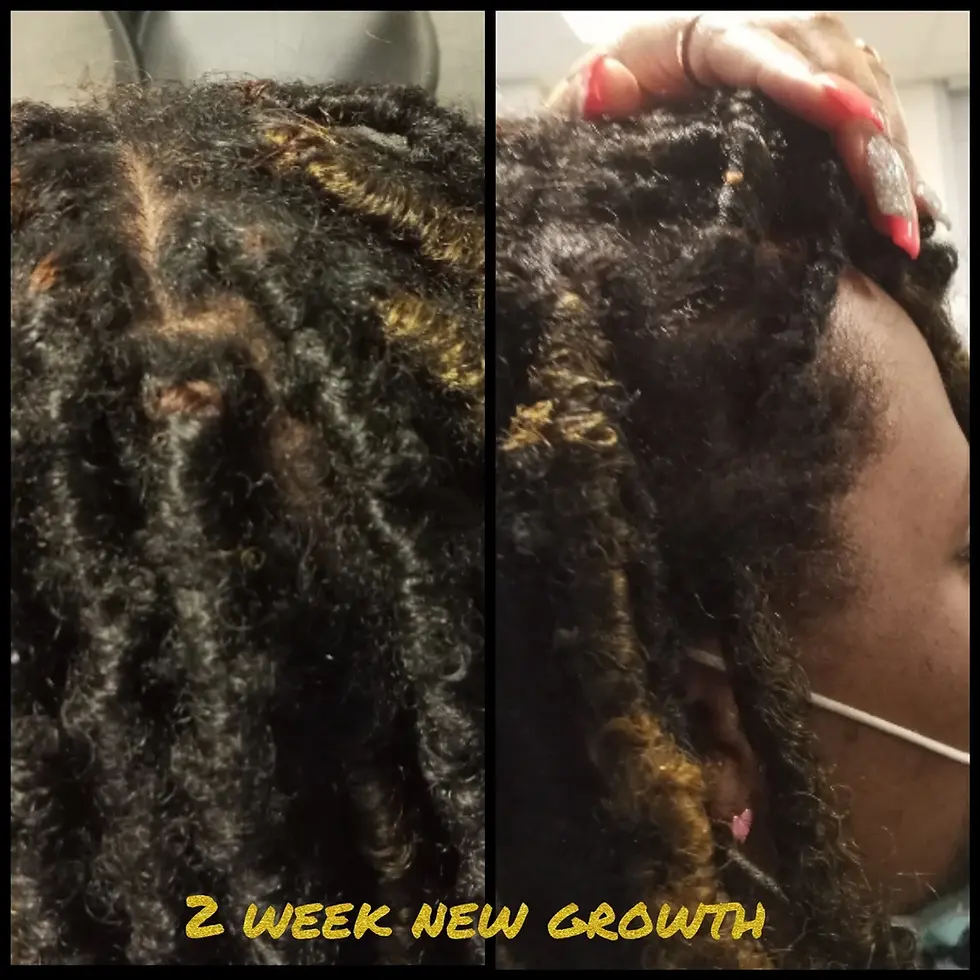 Thumbnail: Alopecia Herbal Mega Growth Oil