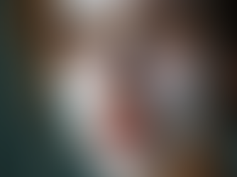 Vitiligo e Direitos: Uma Luta pela Inclusão