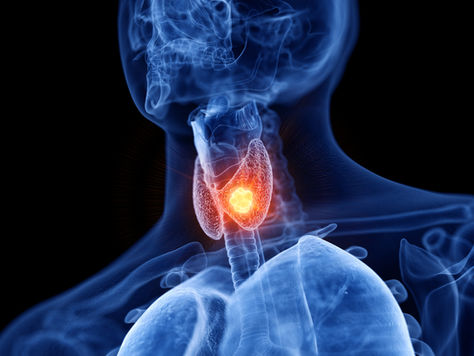 Thyroid Health: Thyroid Cancer Prevention & Complementary Therapies for Treatment