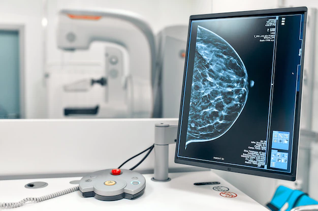 mammogram-snapshot-breasts-female-patient-monitor_