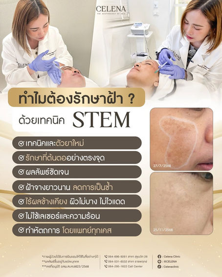 📍ทำไมต้องรักษาฝ้า ด้วยเทคนิค STEM