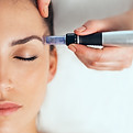 Afbeelding Microneedling