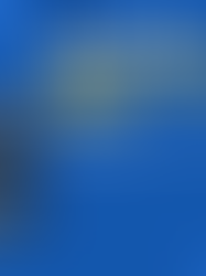 Can You Get a Mobility Scooter Through The NHS