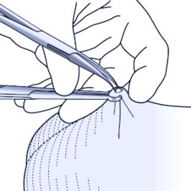 no-scalple-spreader-267x267_edited.jpg