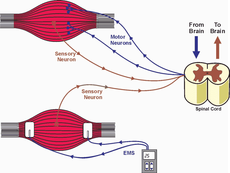 how does ems machine work.gif