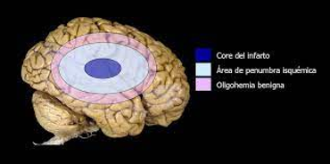 Neurorehabilitación en Madrid