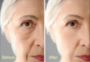 BeforeAndAfter.jpeg